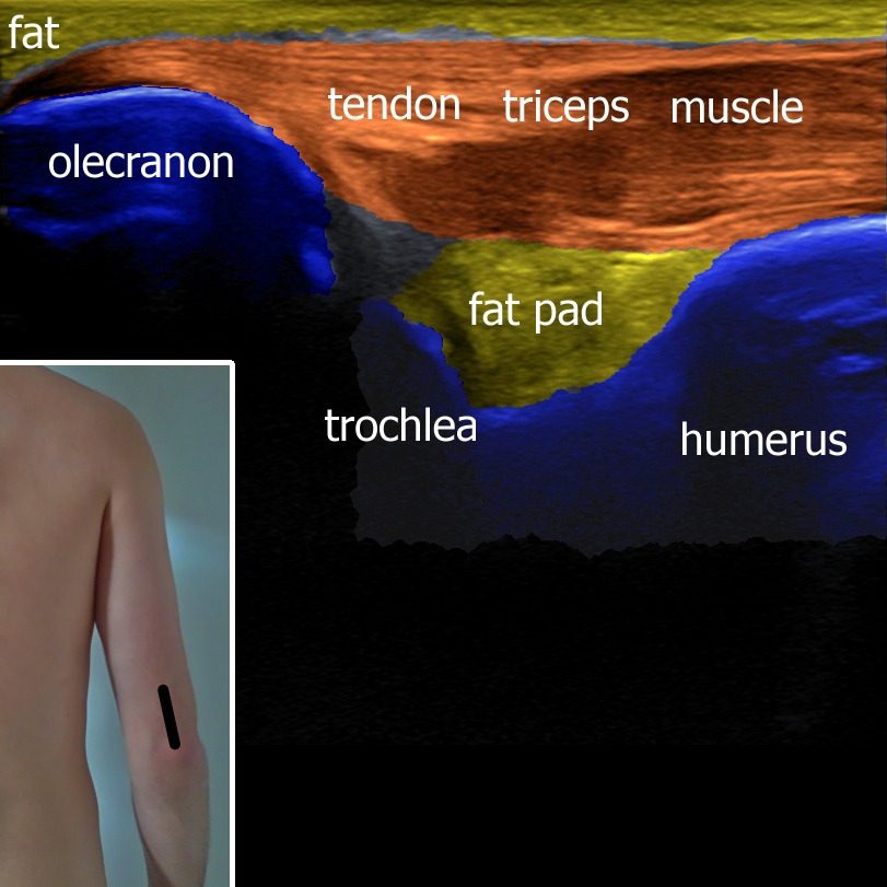 Musculoskeletal ultrasonography