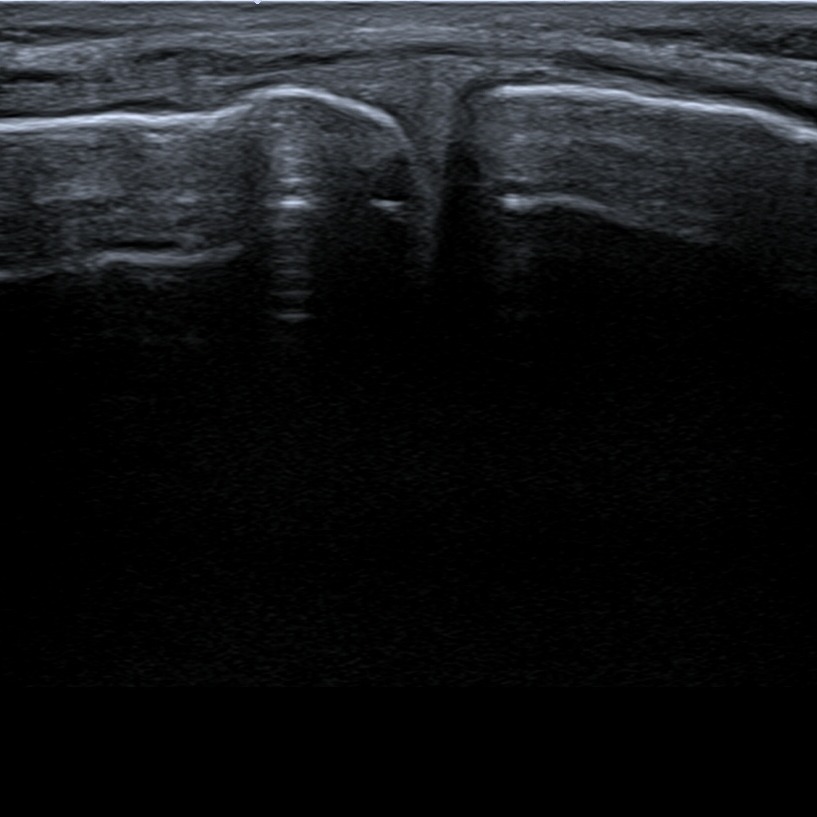 Musculoskeletal ultrasonography