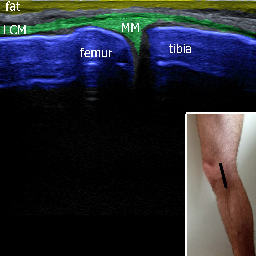 Musculoskeletal ultrasonography