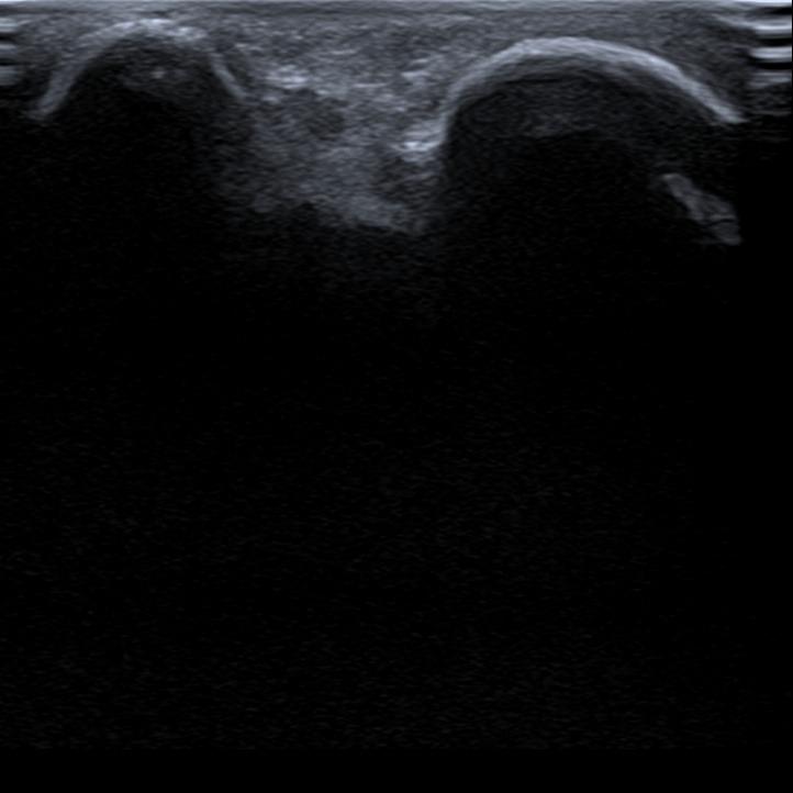 Musculoskeletal ultrasonography