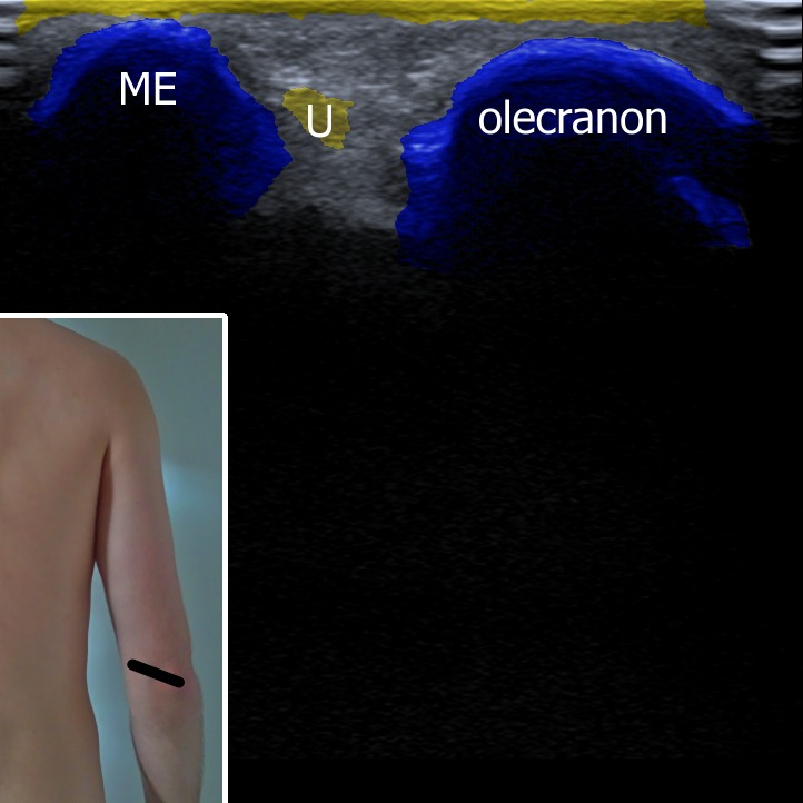 Musculoskeletal ultrasonography