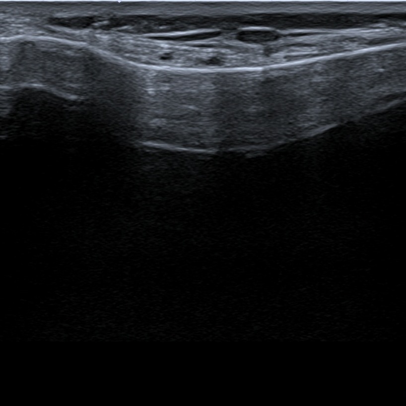 Musculoskeletal ultrasonography