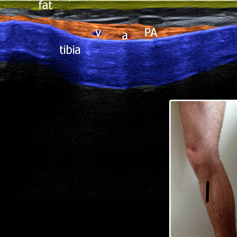 Musculoskeletal ultrasonography