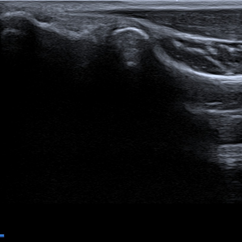 Musculoskeletal ultrasonography