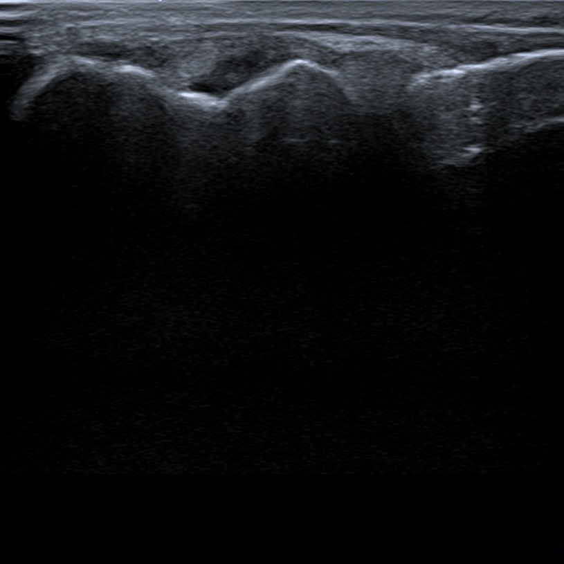 Musculoskeletal ultrasonography