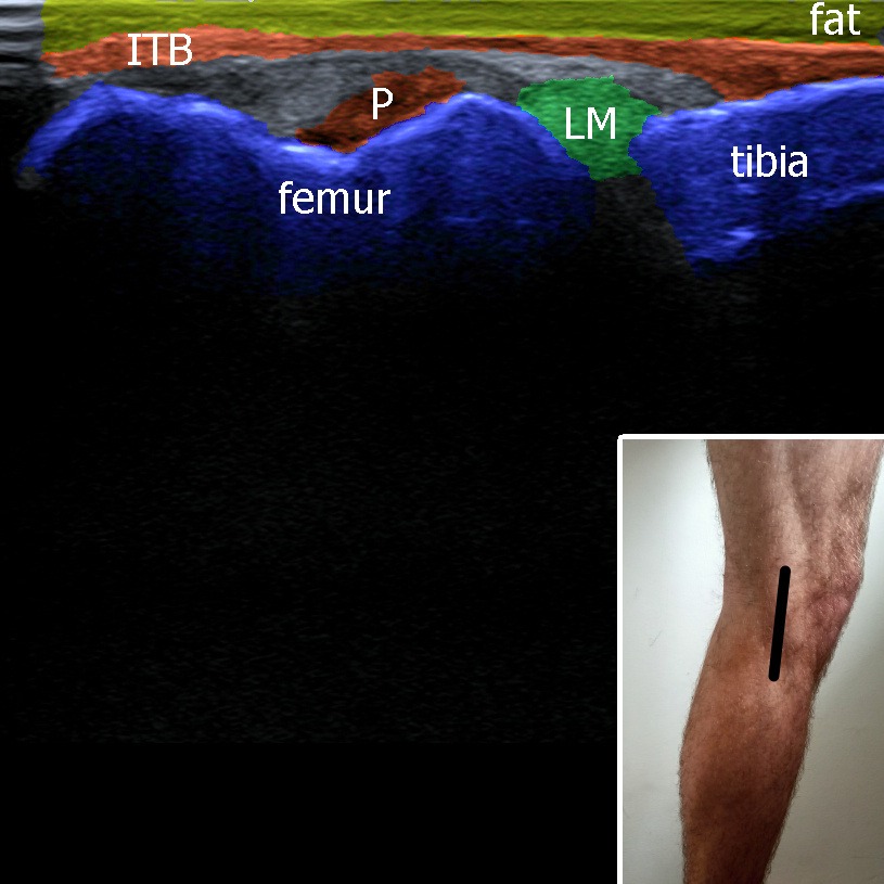 Musculoskeletal ultrasonography