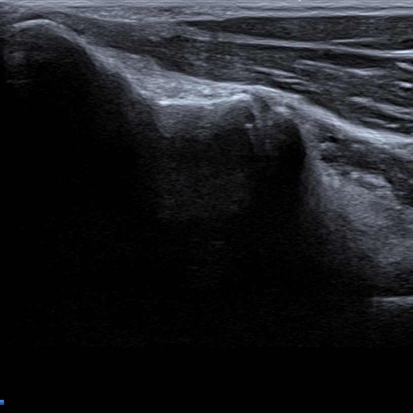 Musculoskeletal ultrasonography