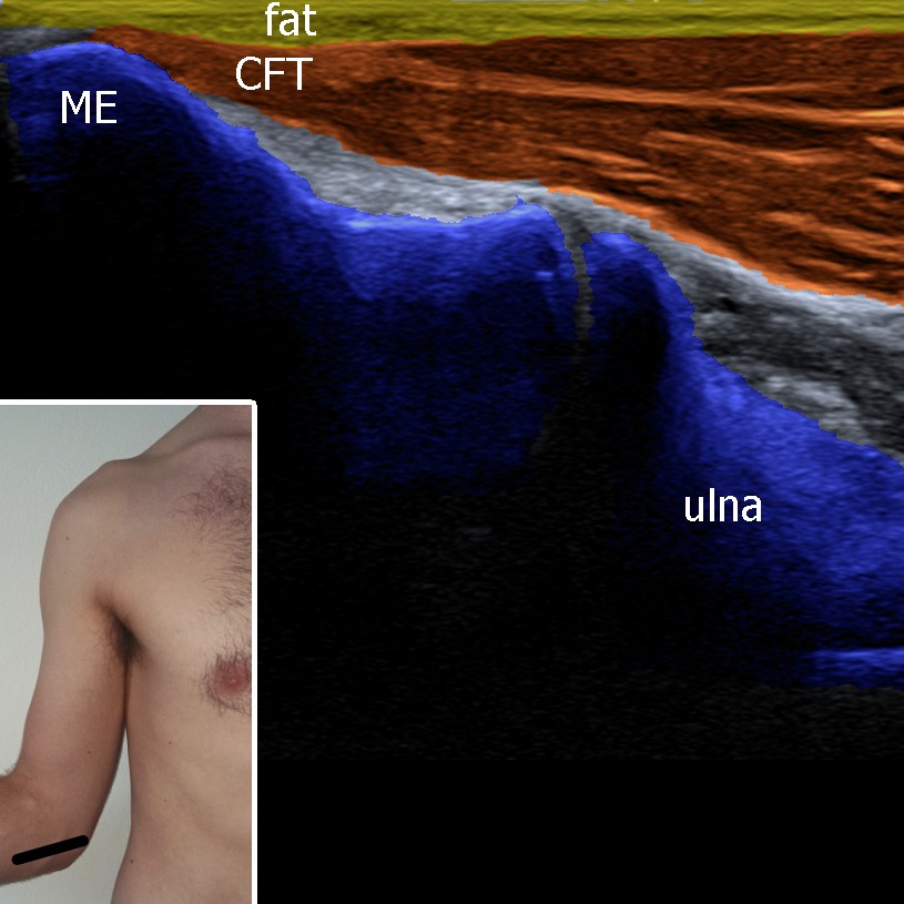 Musculoskeletal ultrasonography