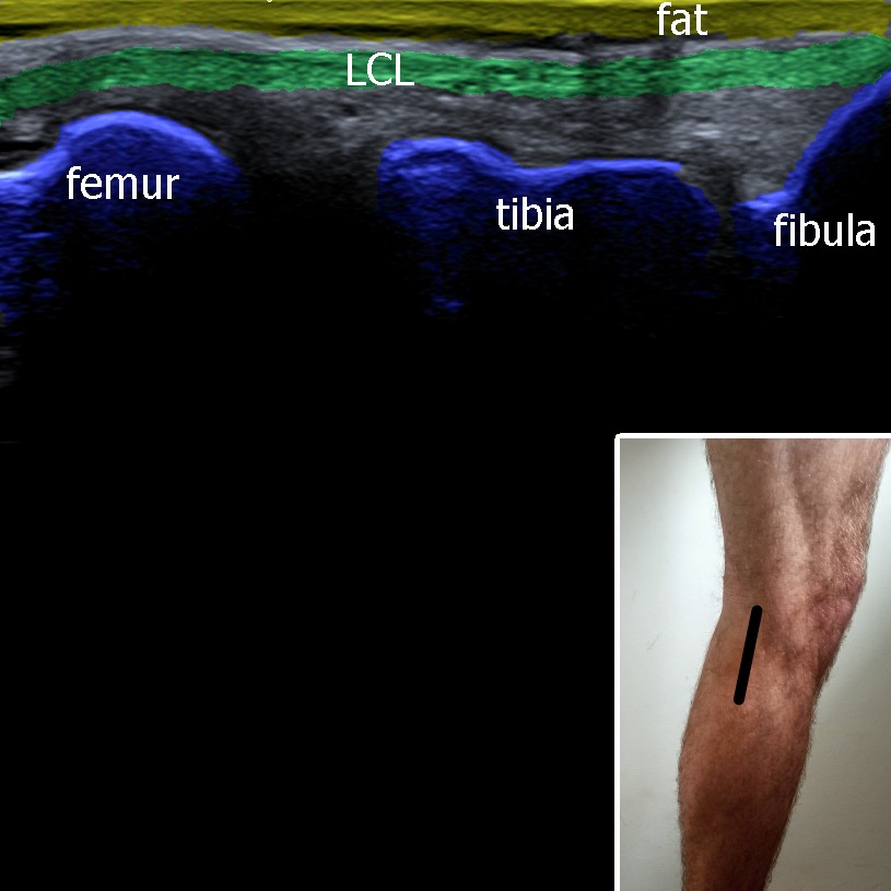 Musculoskeletal ultrasonography