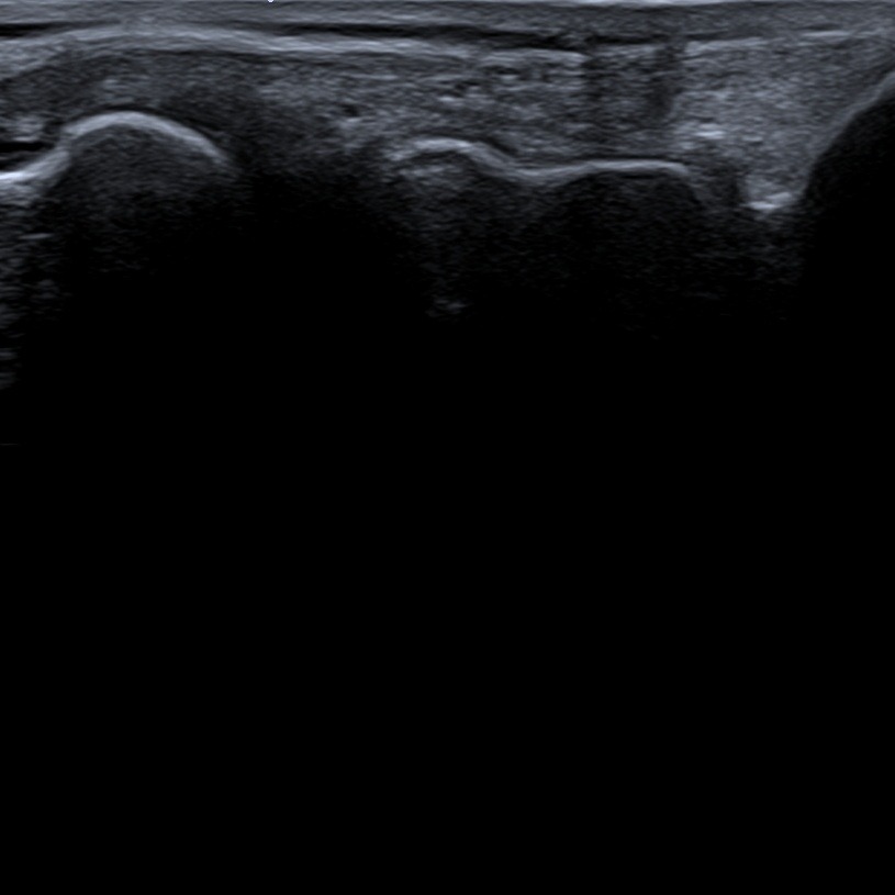 Musculoskeletal ultrasonography