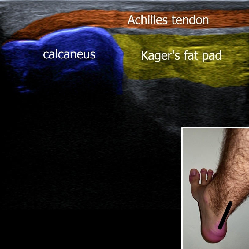 Musculoskeletal ultrasonography