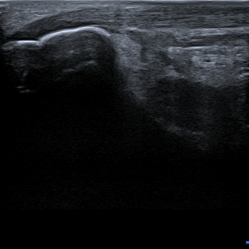 Musculoskeletal ultrasonography