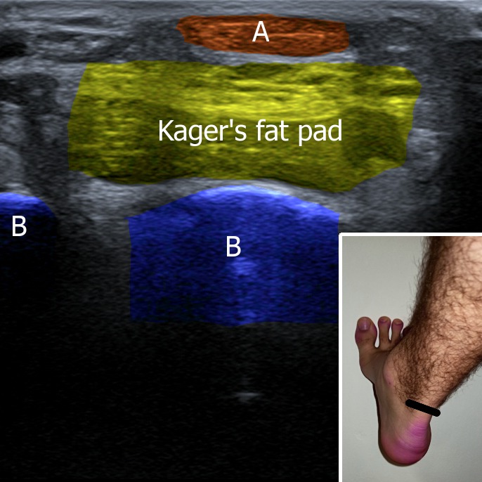 Musculoskeletal ultrasonography