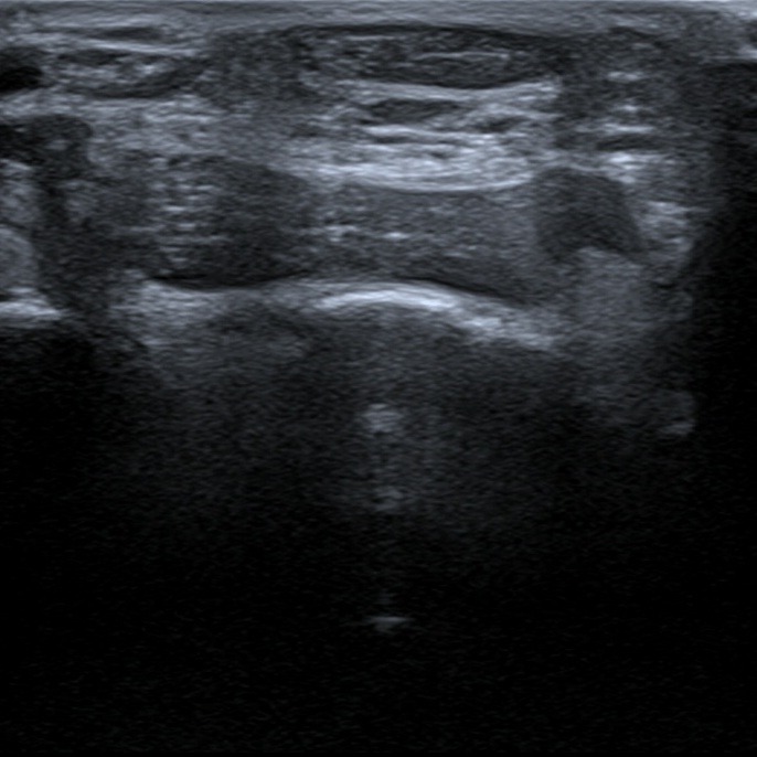 Musculoskeletal ultrasonography