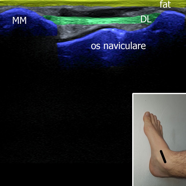 Musculoskeletal ultrasonography