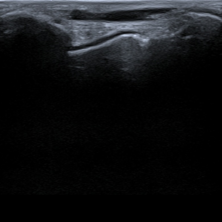 Musculoskeletal ultrasonography