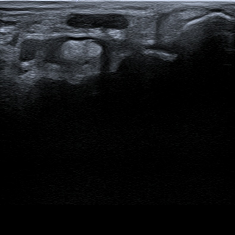 Musculoskeletal ultrasonography