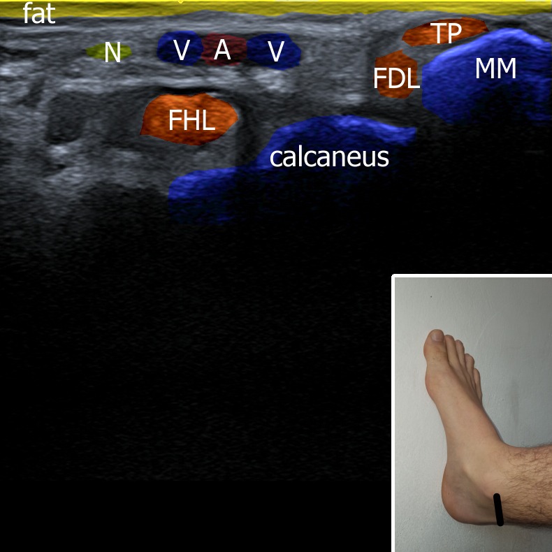 Musculoskeletal ultrasonography