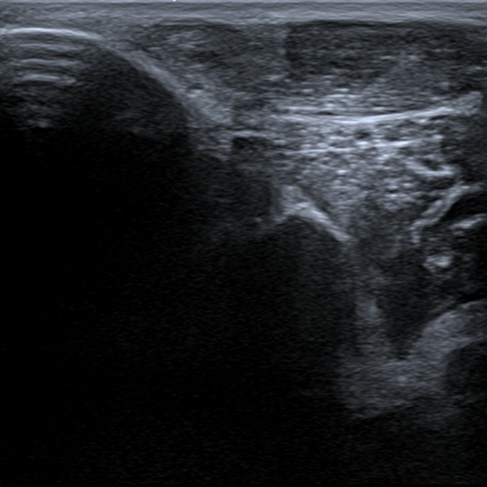 Musculoskeletal ultrasonography