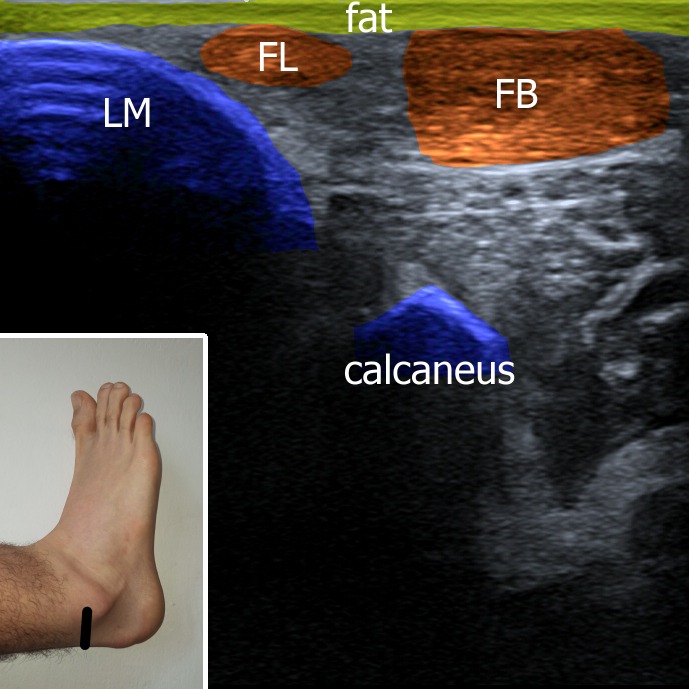 Musculoskeletal ultrasonography