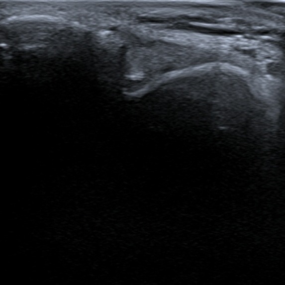 Musculoskeletal ultrasonography