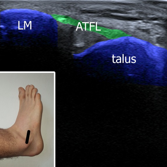 Musculoskeletal ultrasonography