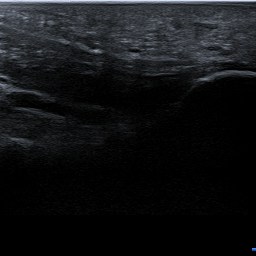 Musculoskeletal ultrasonography