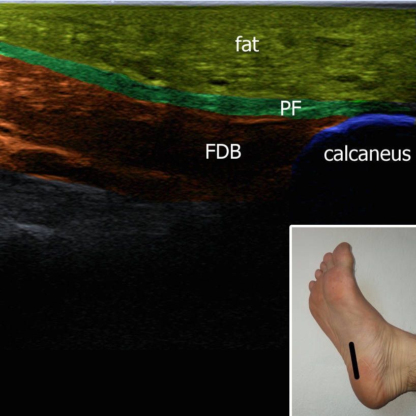 Musculoskeletal ultrasonography