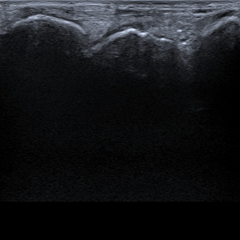 Musculoskeletal ultrasonography