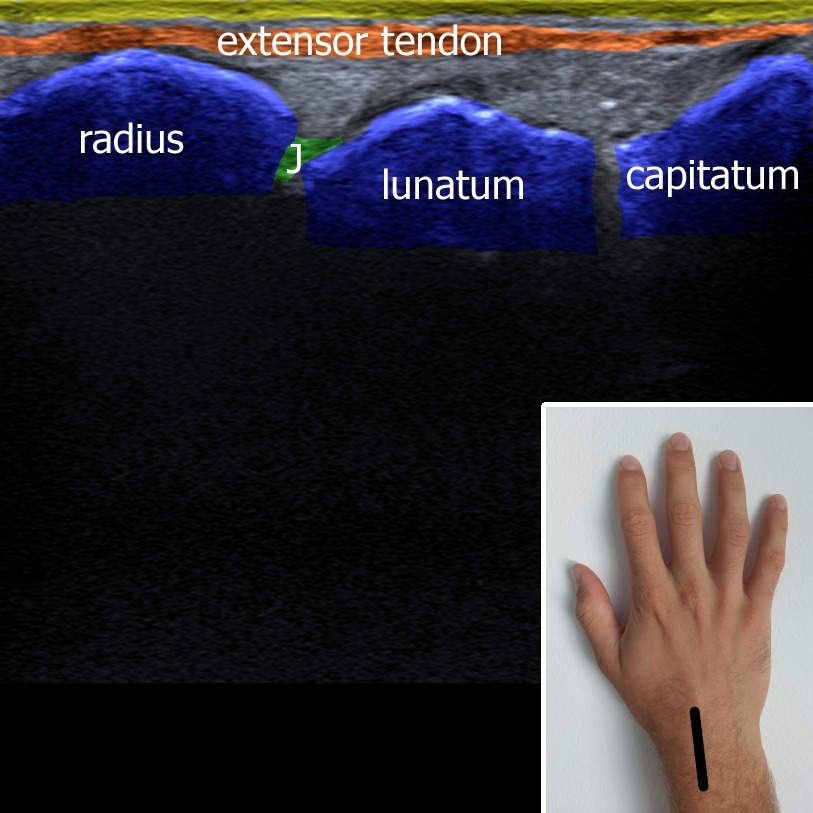 Musculoskeletal ultrasonography