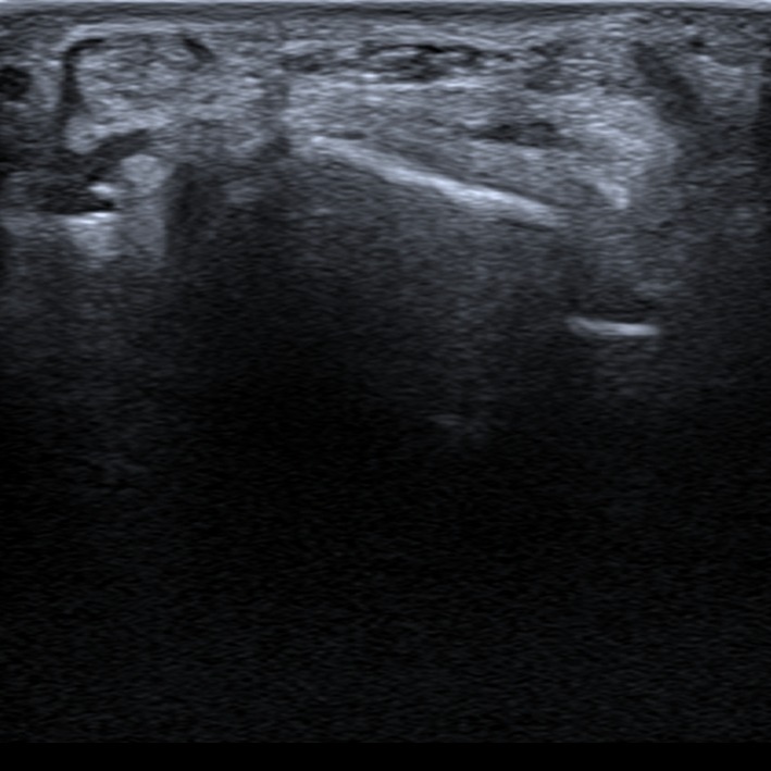 Musculoskeletal ultrasonography