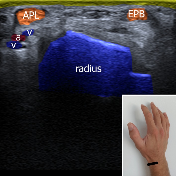 Musculoskeletal ultrasonography