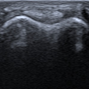 Musculoskeletal ultrasonography