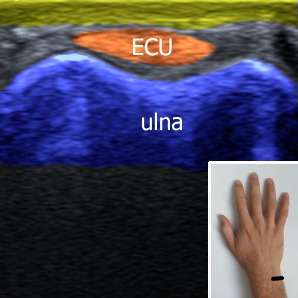 Musculoskeletal ultrasonography