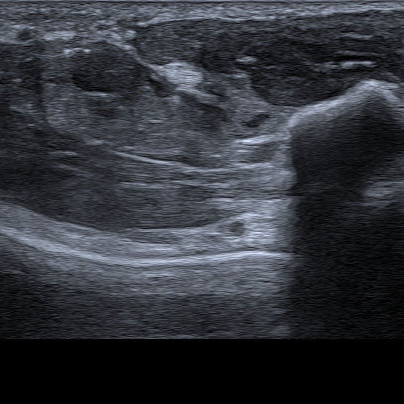 Musculoskeletal ultrasonography