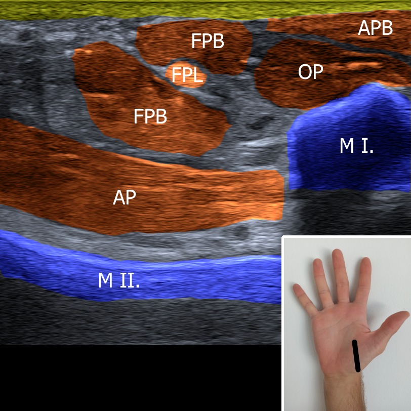 Musculoskeletal ultrasonography