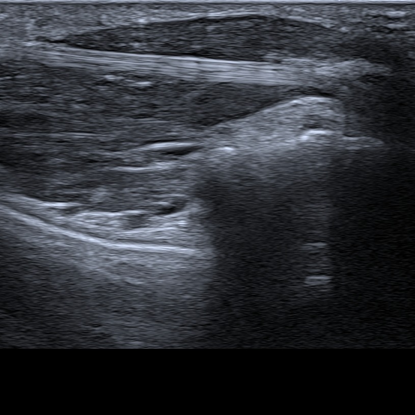 Musculoskeletal ultrasonography