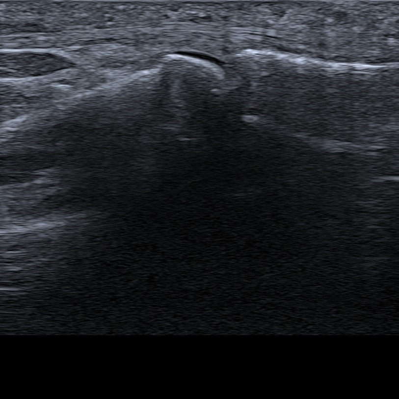 Musculoskeletal ultrasonography