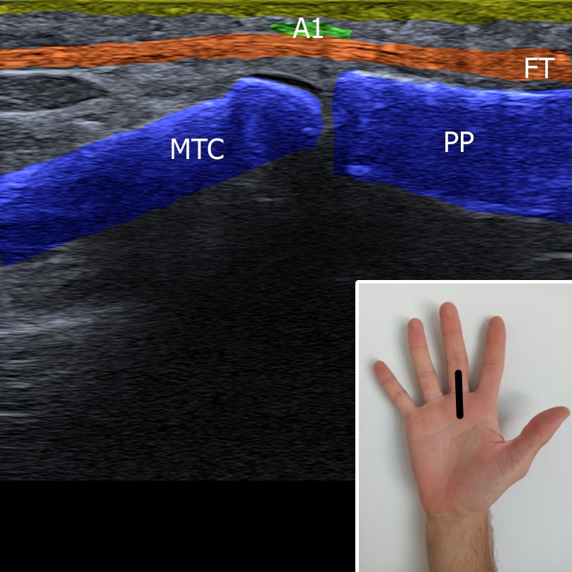 Musculoskeletal ultrasonography