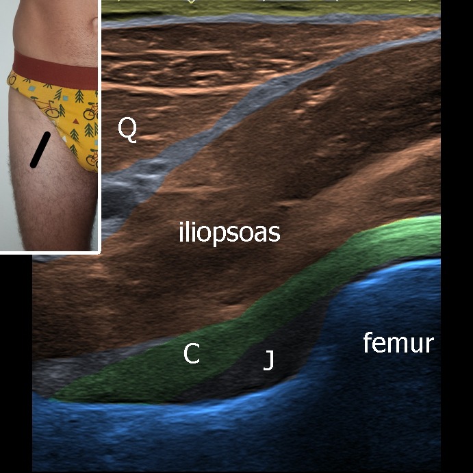 Musculoskeletal ultrasonography